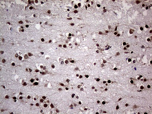m10933 anti pasd5 npas1 mouse monoclonal antibody clone id oti4c10 ihc testing 3