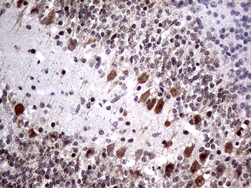 m10933 anti pasd5 npas1 mouse monoclonal antibody clone id oti4c10 ihc testing 4