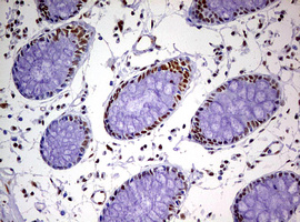 m10946 anti ddx56 mouse monoclonal antibody clone id oti2e5 ihc testing 13