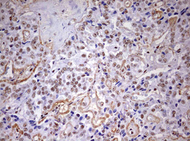 m10946 anti ddx56 mouse monoclonal antibody clone id oti2e5 ihc testing 5