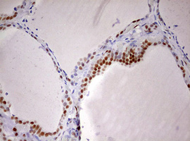 m10946 anti ddx56 mouse monoclonal antibody clone id oti2e5 ihc testing 6