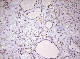 m10946 anti ddx56 mouse monoclonal antibody clone id oti2e5 ihc testing 7