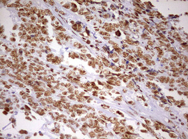 m10946 anti ddx56 mouse monoclonal antibody clone id oti2e5 ihc testing 8