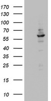 HEK293T cells were transfected with the pCMV6-ENTRY control (Left lane) or pCMV6-ENTRY DDX56 (Right lane) cDNA for 48 hrs and lysed