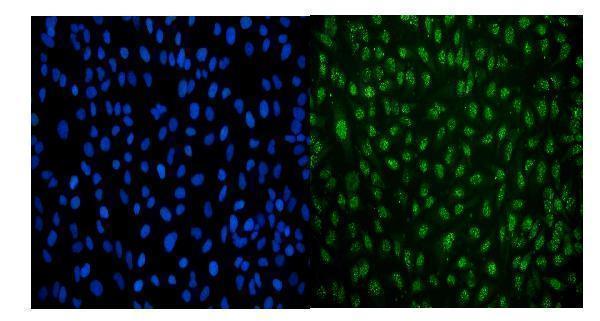 m10947 lsm8 primary antibodies if testing 6