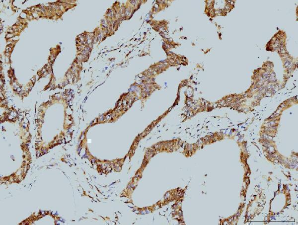 m10947 lsm8 primary antibodies ihc testing 3