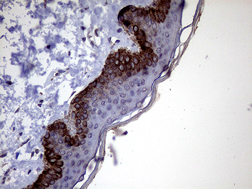 m10966 anti p4ha3 mouse monoclonal antibody clone id oti9a2 ihc testing 1