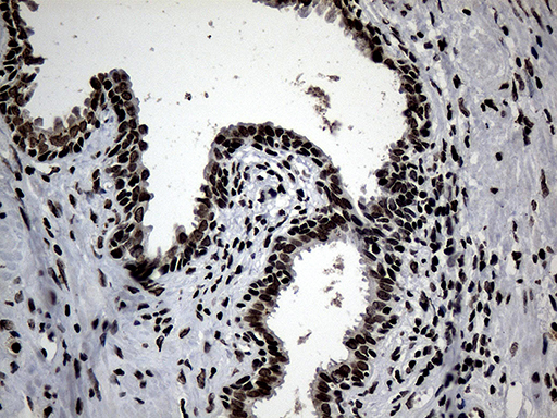 Immunohistochemical staining of paraffin-embedded Human prostate tissue within the normal limits using anti-SF3B14 mouse monoclonal antibody