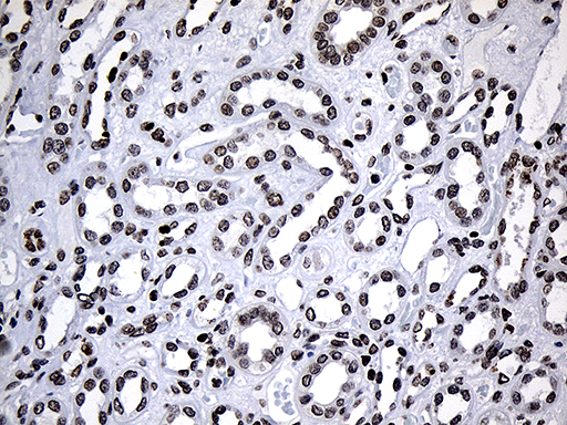 m10990 anti sf3b14 sf3b6 mouse monoclonal antibody clone id oti8a1 ihc testing 4