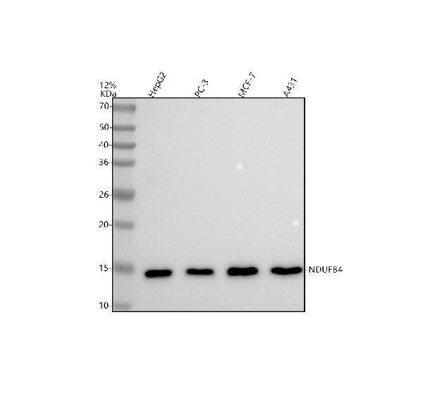  Western blot analysis of NDUFB4 using anti-NDUFB4 antibody (M11016)