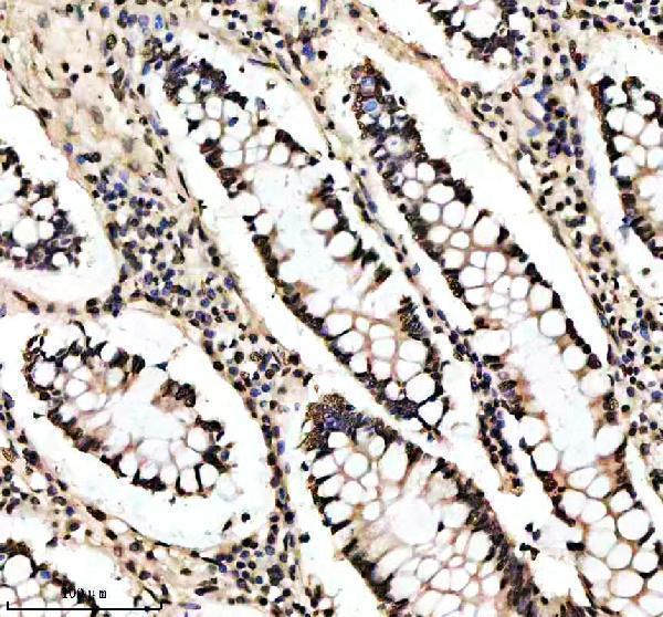 m11068 h2bc12 primary antibodies ihc testing 2_1