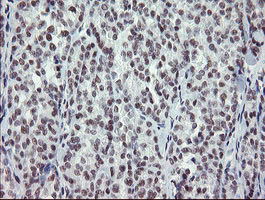 m11133 1 anti dref zbed1 mouse monoclonal antibody clone id oti2a7 ihc testing 4