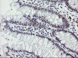 m11133 1 anti dref zbed1 mouse monoclonal antibody clone id oti2a7 ihc testing 5