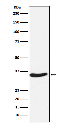 Western blot analysis of EXOSC7 expression in HeLa cell lysate