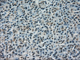 m11167 1 anti scy1 like 3 scyl3 mouse monoclonal antibody clone id oti4f10 ihc testing 3