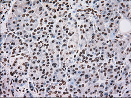 Immunohistochemical staining of paraffin-embedded pancreas tissue within the normal limits using anti-SCYL3mouse monoclonal antibody
