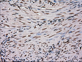 m11167 anti scy1 like 3 scyl3 mouse monoclonal antibody clone id oti1a5 ihc testing 4