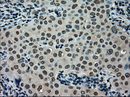 m11167 anti scy1 like 3 scyl3 mouse monoclonal antibody clone id oti1a5 ihc testing 6