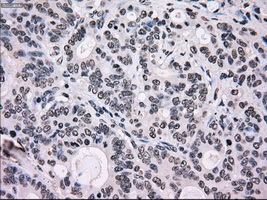 m11167 anti scy1 like 3 scyl3 mouse monoclonal antibody clone id oti1a5 ihc testing 7