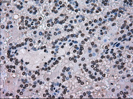 m11167 anti scy1 like 3 scyl3 mouse monoclonal antibody clone id oti1a5 ihc testing 8