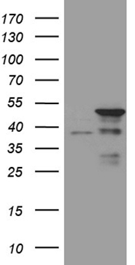 HEK293T cells were transfected with the pCMV6-ENTRY control (Left lane) or pCMV6-ENTRY TAF1A (Right lane) cDNA for 48 hrs and lysed