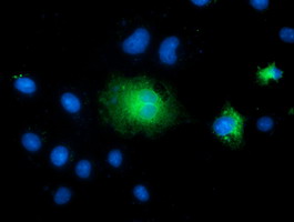 Anti-TCTN2 mouse monoclonal antibody (M11196) immunofluorescent staining of COS7 cells transiently transfected by pCMV6-ENTRY TCTN2