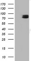 HEK293T cells were transfected with the pCMV6-ENTRY control (Left lane) or pCMV6-ENTRY TCTN2 (Right lane) cDNA for 48 hrs and lysed
