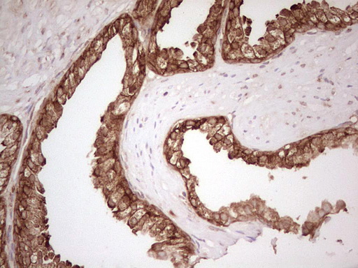 m11210 anti wibg pym1 mouse monoclonal antibody clone id oti5e2 ihc testing 11