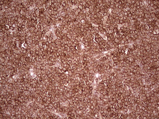 m11210 anti wibg pym1 mouse monoclonal antibody clone id oti5e2 ihc testing 12