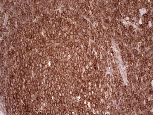 m11210 anti wibg pym1 mouse monoclonal antibody clone id oti5e2 ihc testing 13
