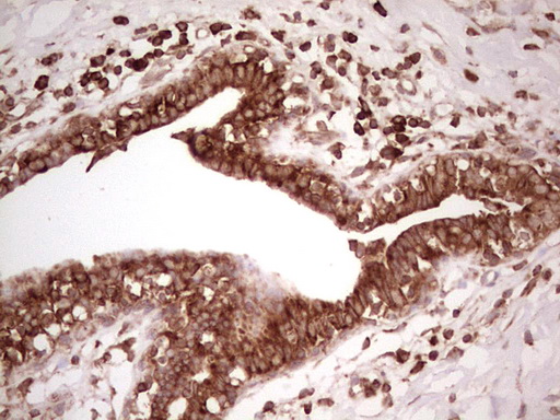 m11210 anti wibg pym1 mouse monoclonal antibody clone id oti5e2 ihc testing 14