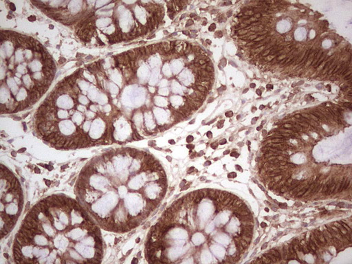 m11210 anti wibg pym1 mouse monoclonal antibody clone id oti5e2 ihc testing 15