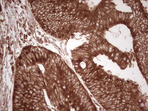 m11210 anti wibg pym1 mouse monoclonal antibody clone id oti5e2 ihc testing 16