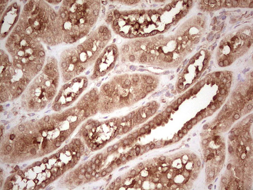 m11210 anti wibg pym1 mouse monoclonal antibody clone id oti5e2 ihc testing 17
