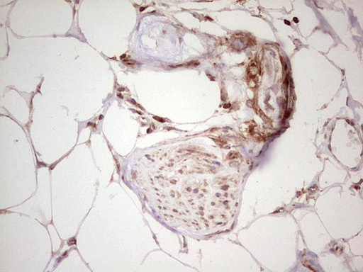 m11210 anti wibg pym1 mouse monoclonal antibody clone id oti5e2 ihc testing 18