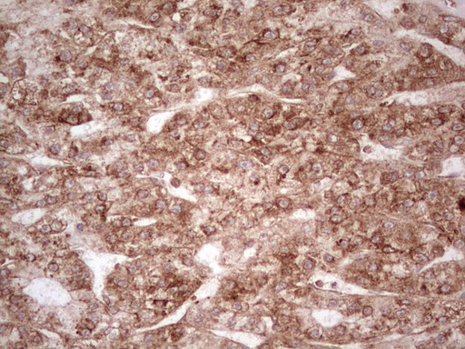 m11210 anti wibg pym1 mouse monoclonal antibody clone id oti5e2 ihc testing 20