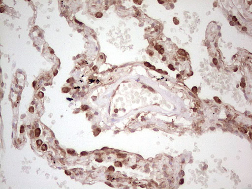 m11210 anti wibg pym1 mouse monoclonal antibody clone id oti5e2 ihc testing 21