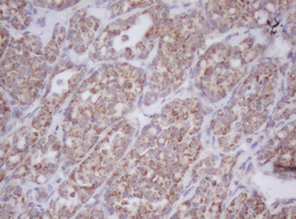m11221 1 anti mitocondrial translational initiation factor 3 mtif3 mouse monoclonal antibody clone id oti1e8 ihc testing 4