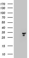 HEK293T cells were transfected with the pCMV6-ENTRY control (Left lane) or pCMV6-ENTRY MTIF3 (Right lane) cDNA for 48 hrs and lysed