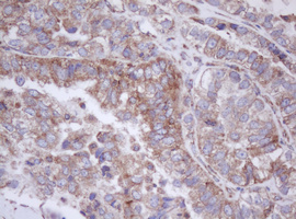 m11221 anti mitocondrial translational initiation factor 3 mtif3 mouse monoclonal antibody clone id oti4b6 ihc testing 4