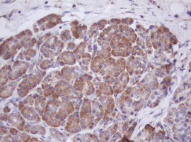m11221 anti mitocondrial translational initiation factor 3 mtif3 mouse monoclonal antibody clone id oti4b6 ihc testing 5
