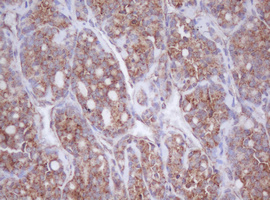 m11221 anti mitocondrial translational initiation factor 3 mtif3 mouse monoclonal antibody clone id oti4b6 ihc testing 6