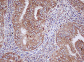 m11221 anti mitocondrial translational initiation factor 3 mtif3 mouse monoclonal antibody clone id oti4b6 ihc testing 7