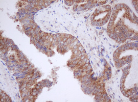 m11221 anti mitocondrial translational initiation factor 3 mtif3 mouse monoclonal antibody clone id oti4b6 ihc testing 8