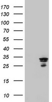 HEK293T cells were transfected with the pCMV6-ENTRY control (Left lane) or pCMV6-ENTRY MTIF3 (Right lane) cDNA for 48 hrs and lysed