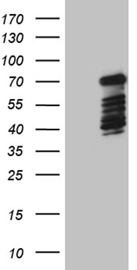 HEK293T cells were transfected with the pCMV6-ENTRY control (Left lane) or pCMV6-ENTRY DCP1B (Right lane) cDNA for 48 hrs and lysed. Equivalent amounts of cell lysates (5 ug per lane) were separated by SDS-PAGE and immunoblotted with anti-DCP1B (1:2000).