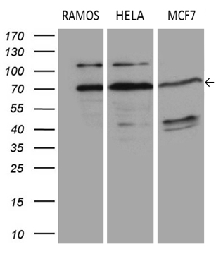 Western blot analysis of extracts (35ug) from 3 different cell lines by using anti-DCP1B monoclonal antibody (1:500).