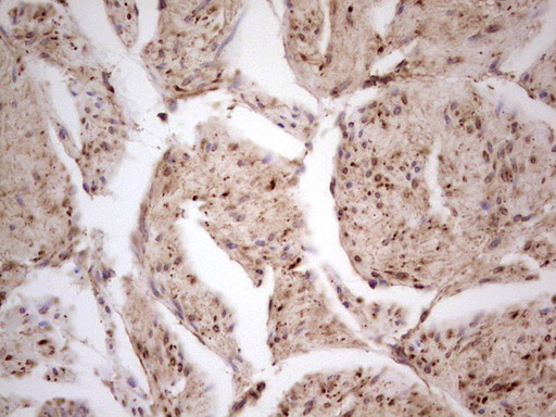 m11252 anti cdkl1 mouse monoclonal antibody clone id oti1d9 ihc testing 2