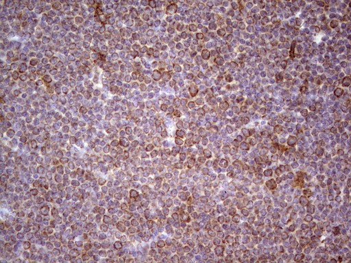 m11252 anti cdkl1 mouse monoclonal antibody clone id oti1d9 ihc testing 3