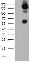 HEK293T cells were transfected with the pCMV6-ENTRY control (Left lane) or pCMV6-ENTRY BTN1A1 (Right lane) cDNA for 48 hrs and lysed